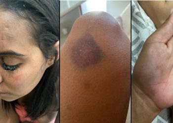 Você viu? Vereador está sendo acusado de espancar amante. Ele nega