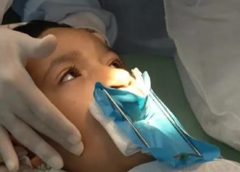 Hospital de Feira de Santana oferecerá cirurgias gratuitas de lábio leporino e fenda palatina