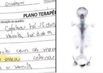 SP – Erro médico faz mulher tratar câncer inexistente por seis anos