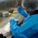 Novo teste de HPV no SUS pode antecipar diagnóstico em até 10 anos