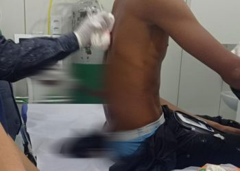 Adolescente de 13 anos é socorrido para hospital com faca cravada nas costas após confusão em bar