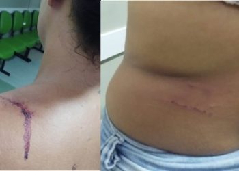 Mulher com medida protetiva sofre tentativa de feminicídio. Ex-companheiro está sendo procurado