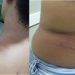 Mulher com medida protetiva sofre tentativa de feminicídio. Ex-companheiro está sendo procurado