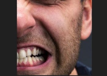 Bruxismo: dentista explica como o ato de ranger os dentes pode afetar a saúde
