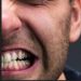 Bruxismo: dentista explica como o ato de ranger os dentes pode afetar a saúde
