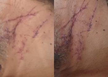 Advogado diz que idoso preso em Nordestina agiu em legítima defesa ao matar lavrador