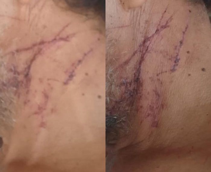 Advogado diz que idoso preso em Nordestina agiu em legítima defesa ao matar lavrador