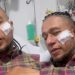 Jornalista da TV Subaé fica ferido ao cair de cavalo em Serrinha