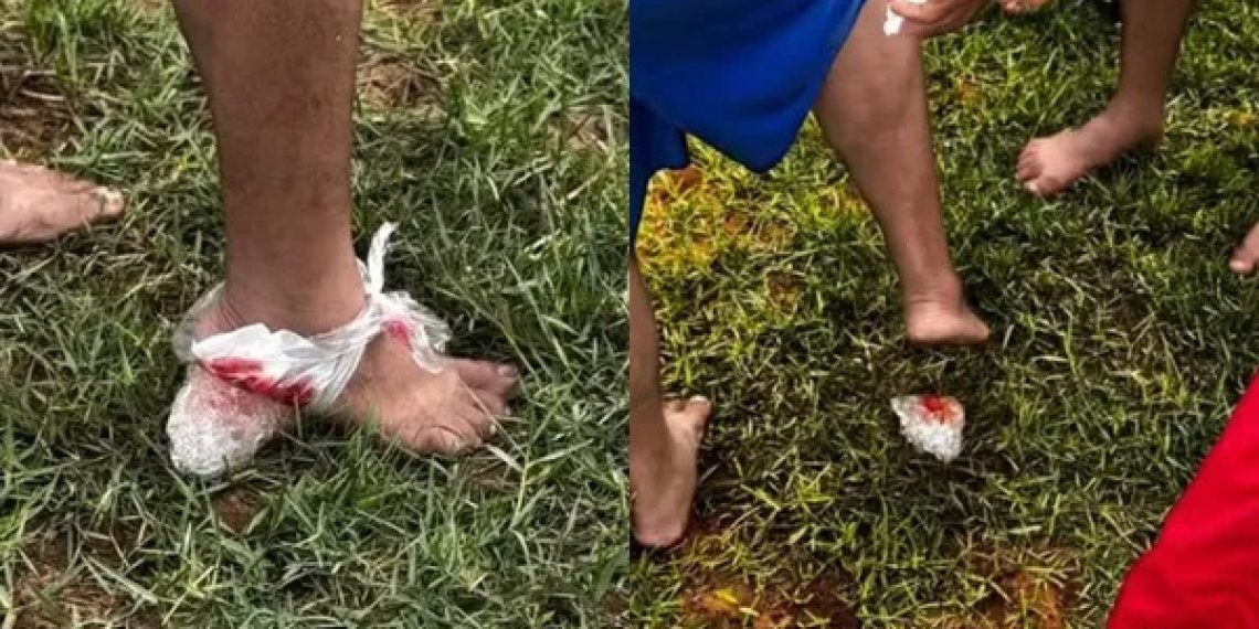 Ataque de piranhas deixa feridos em Iaçu e prefeitura deve interditar trecho do Rio Paraguaçu