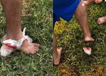 Ataque de piranhas deixa feridos em Iaçu e prefeitura deve interditar trecho do Rio Paraguaçu