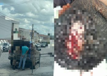 Subcomandante do Águia Resgate é ferido por golpe de facão na cabeça no centro de Coité