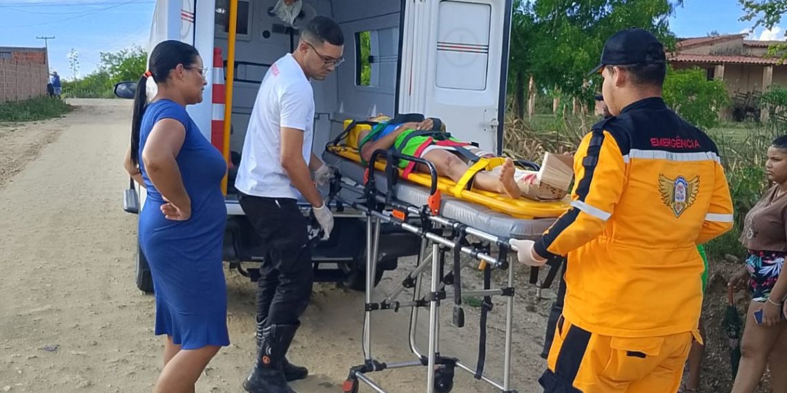Adolescente sofre fratura exposta após queda de moto em povoado; irmão também fica ferido